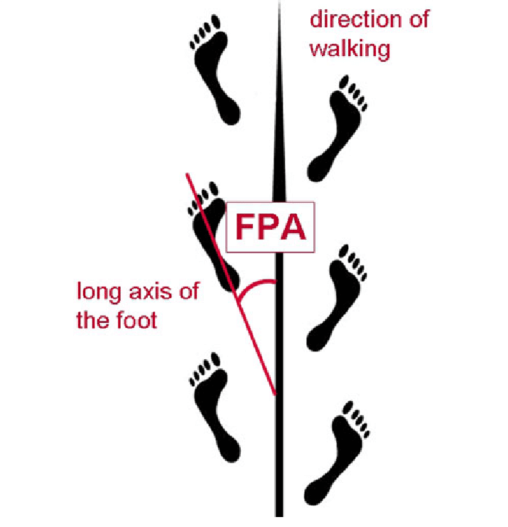 foot progression angle